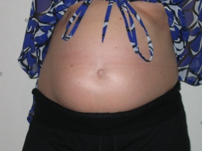 obrázek 22. týden těhotenství - profil