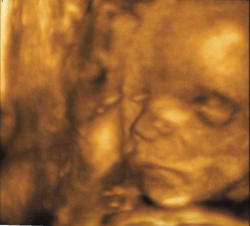 obrázek Adamek na 3D ultrazvuku