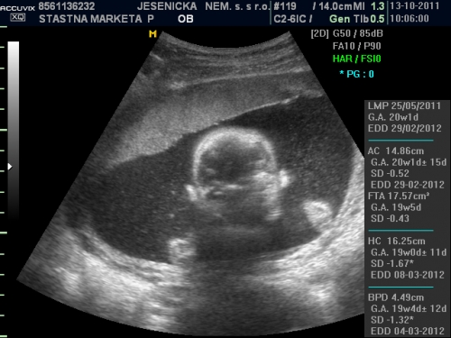 obrázek ultrazvuk