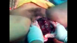 video Přirozený vaginální porod (1)