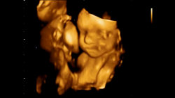 video 4D ultrazvuk ve 27. týdnu těhotenství